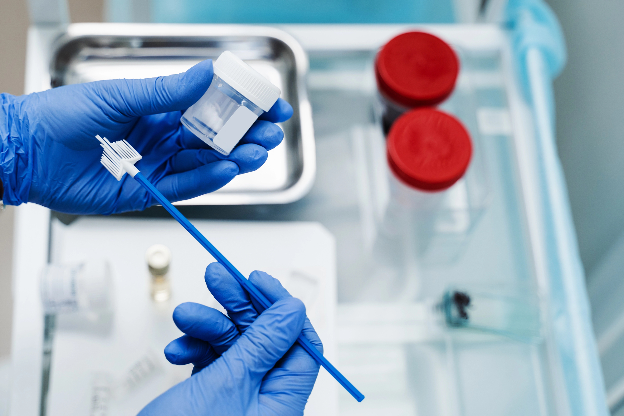 Smear testi pap smear rahim ağzı taraması